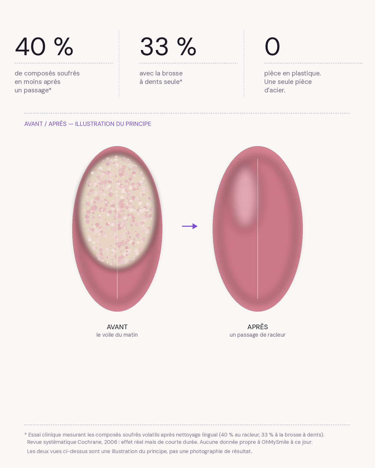 40 % au racleur, 33 % à la brosse à dents, 0 plastique — et l'avant/après du voile lingual en illustration
