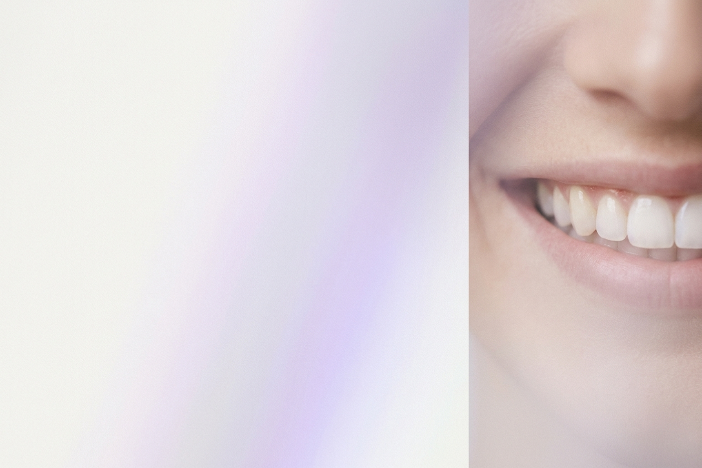 Sourire lumineux sur fond blanc iridescent violet — OhMySmile