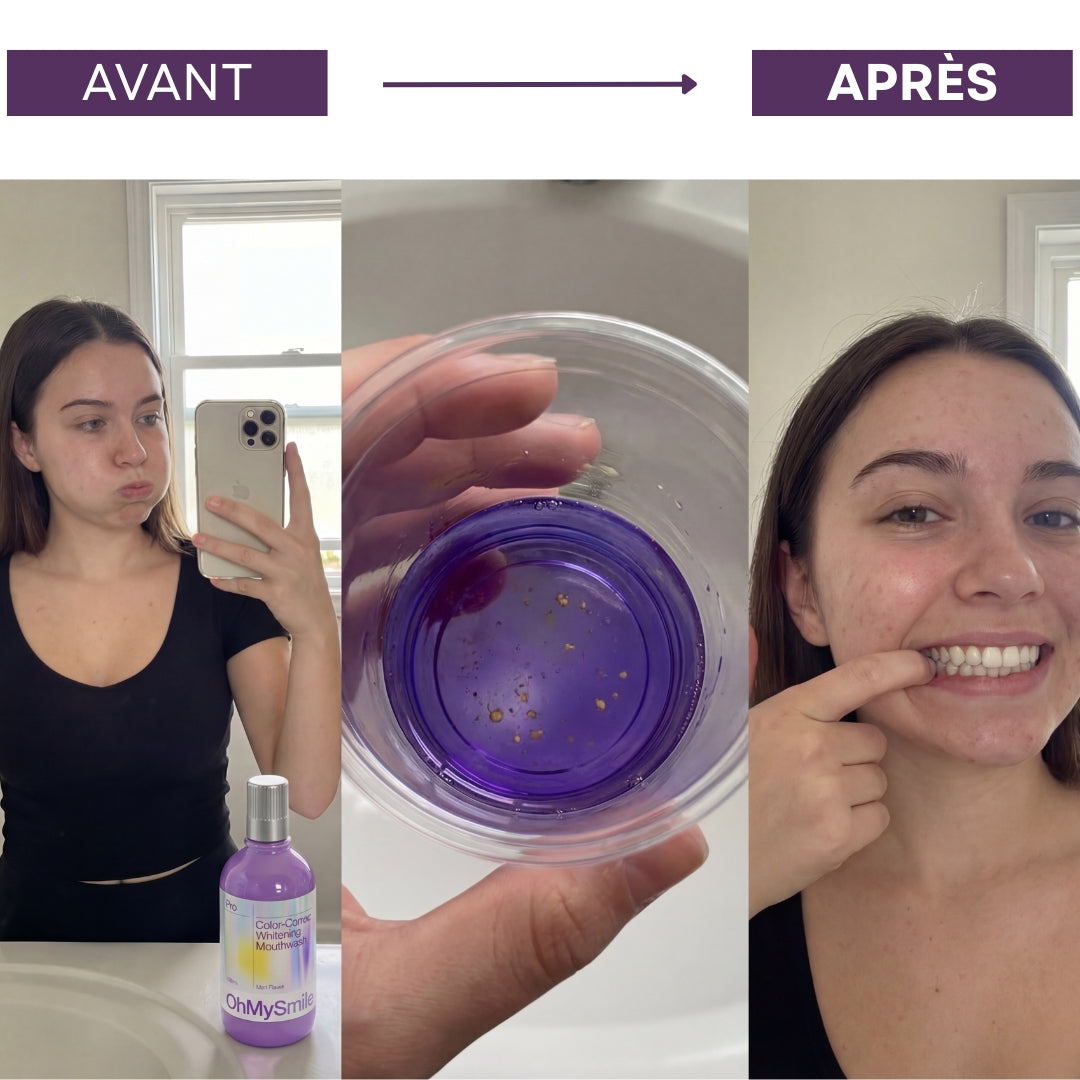 OhMySmile® - Bain De Bouche Blanchissant