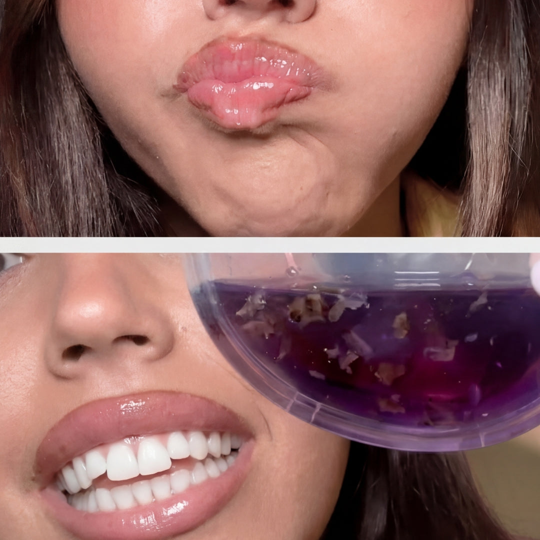 OhMySmile® - Bain De Bouche Blanchissant